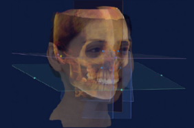 Virtual Patient(仮想患者)
